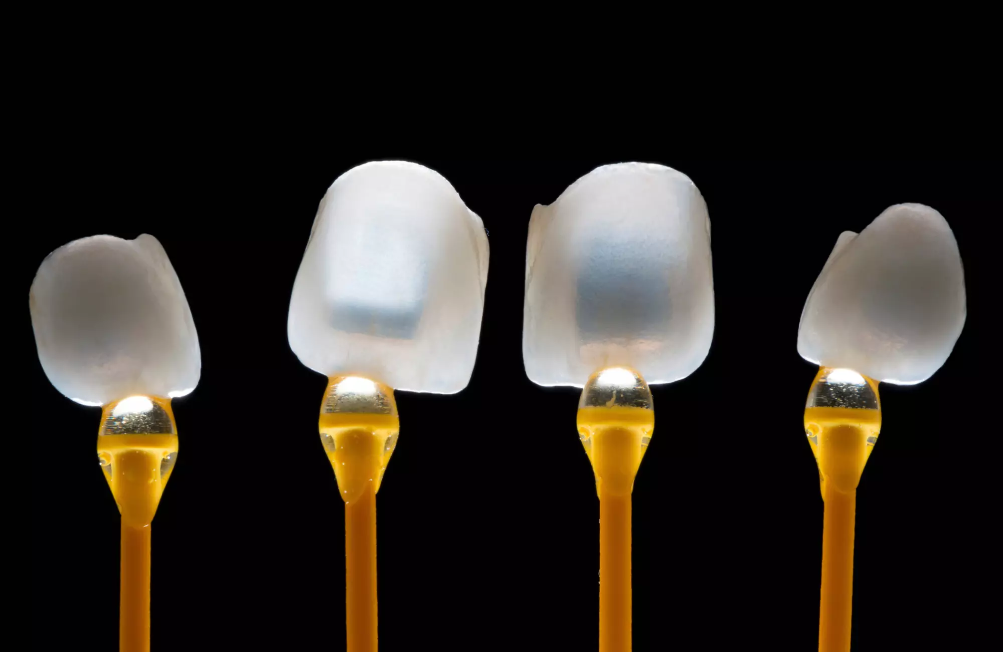 Veneers in Tijuana