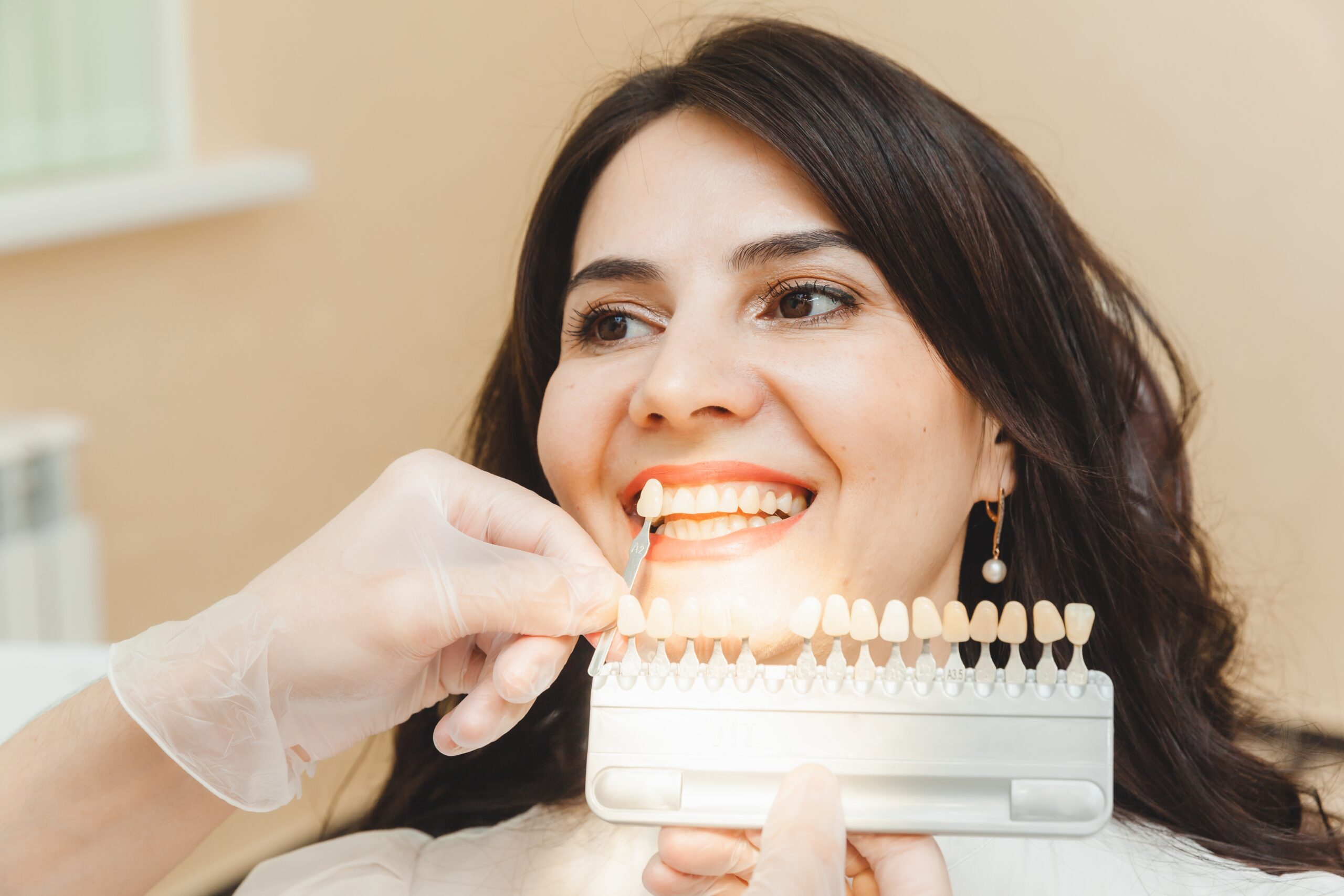 Dental Veneers Tijuana