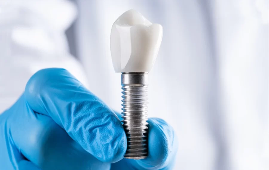 dental-implants