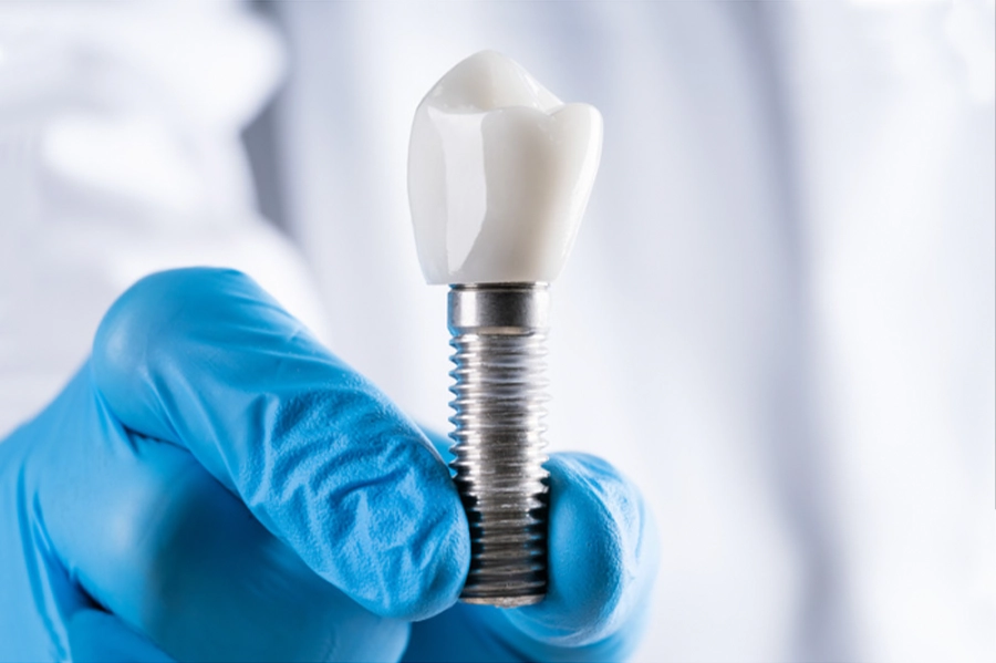 dental-implants