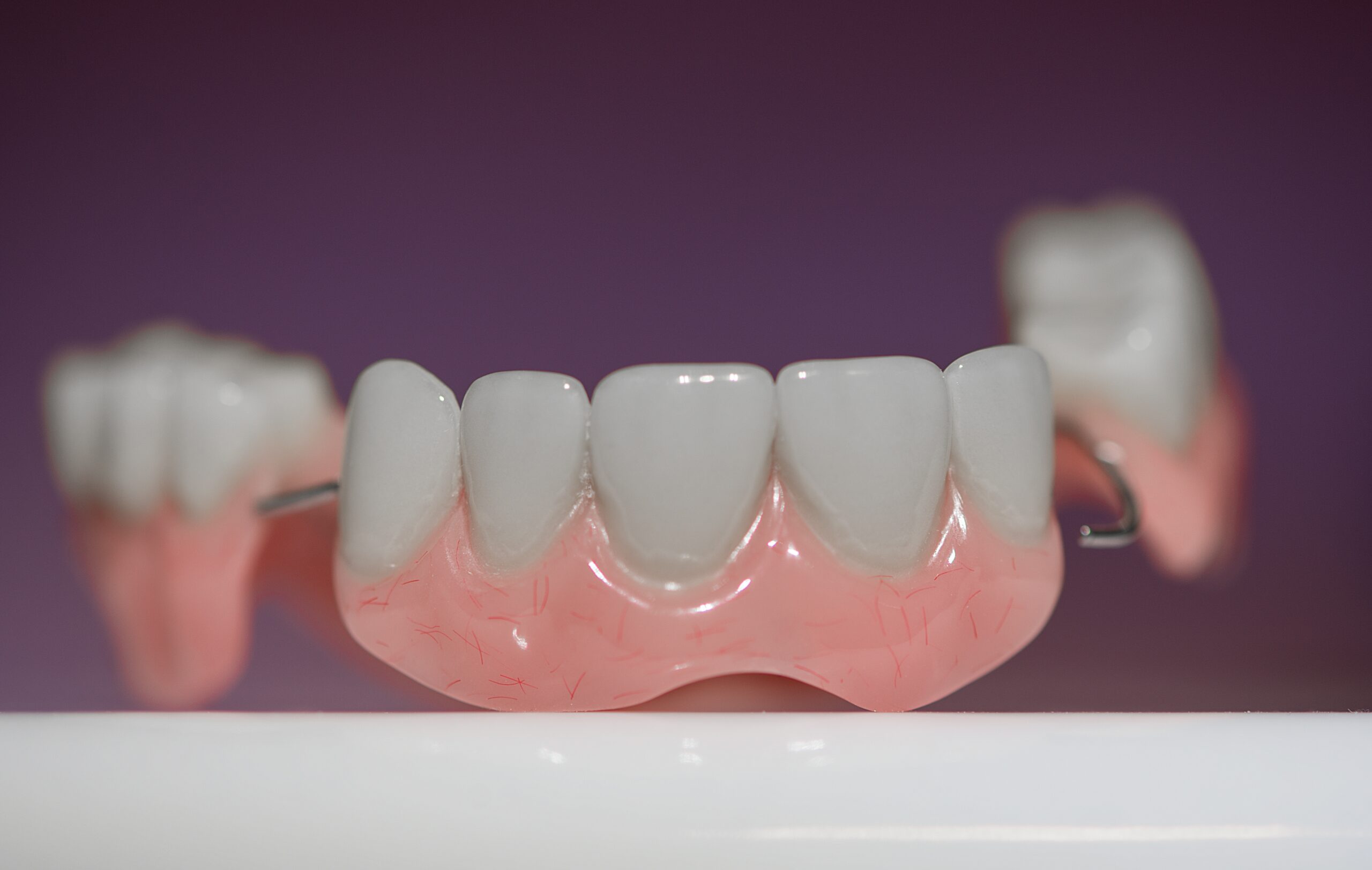 Dental implant - Dental Crown