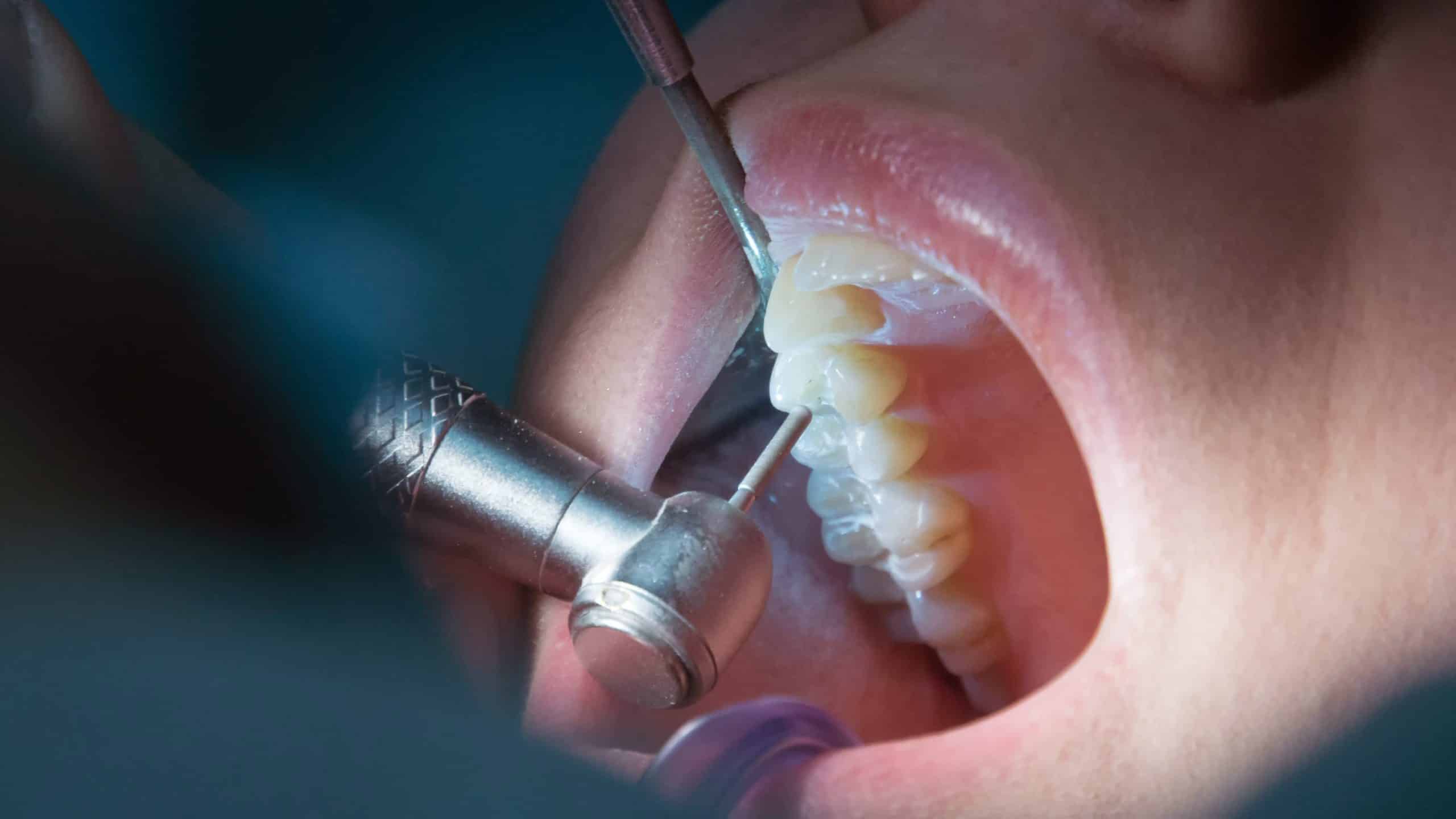 endodontics tijuana