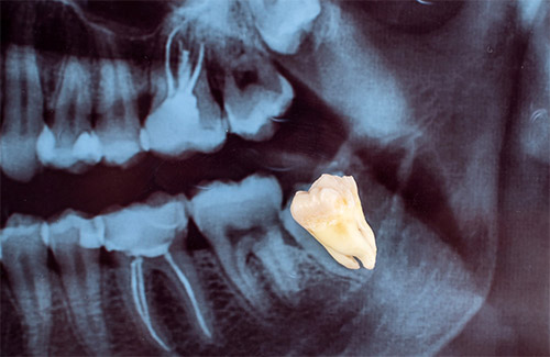 cirugia oral