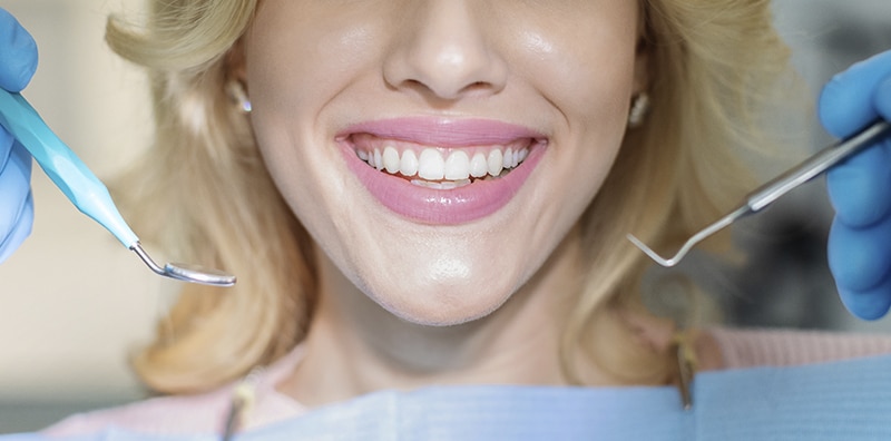 Dental whitening