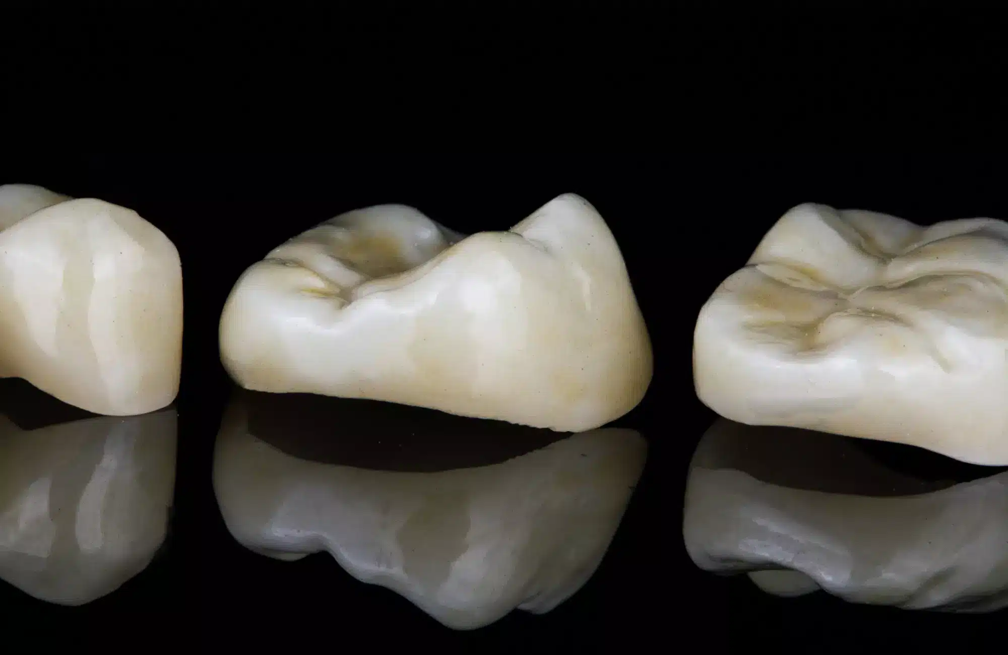 Dental crowns in Tijuana