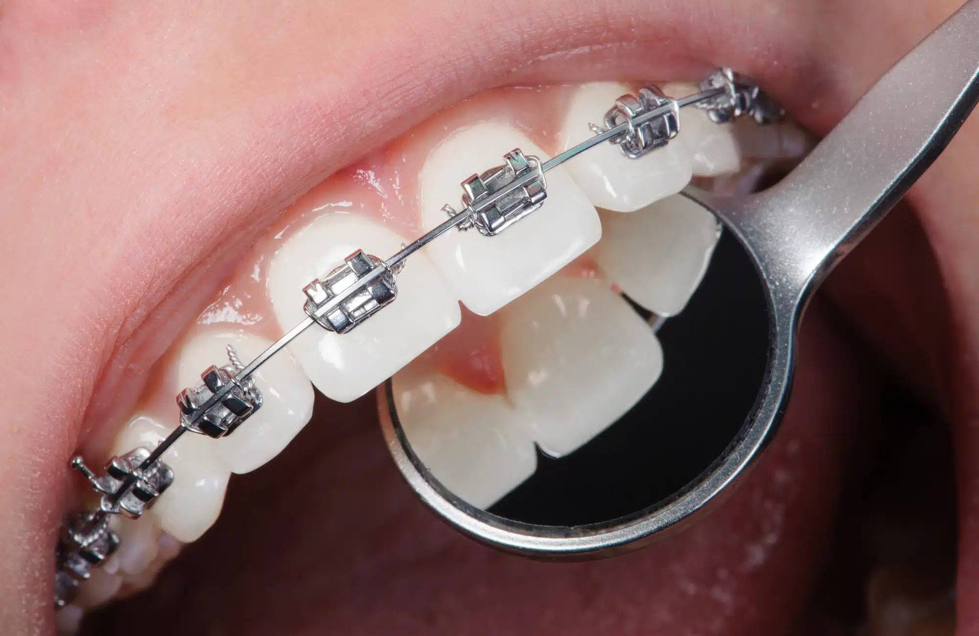 orthodontist-in-tijuana