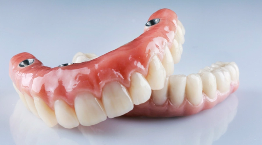 dental-implants-in-tijuana