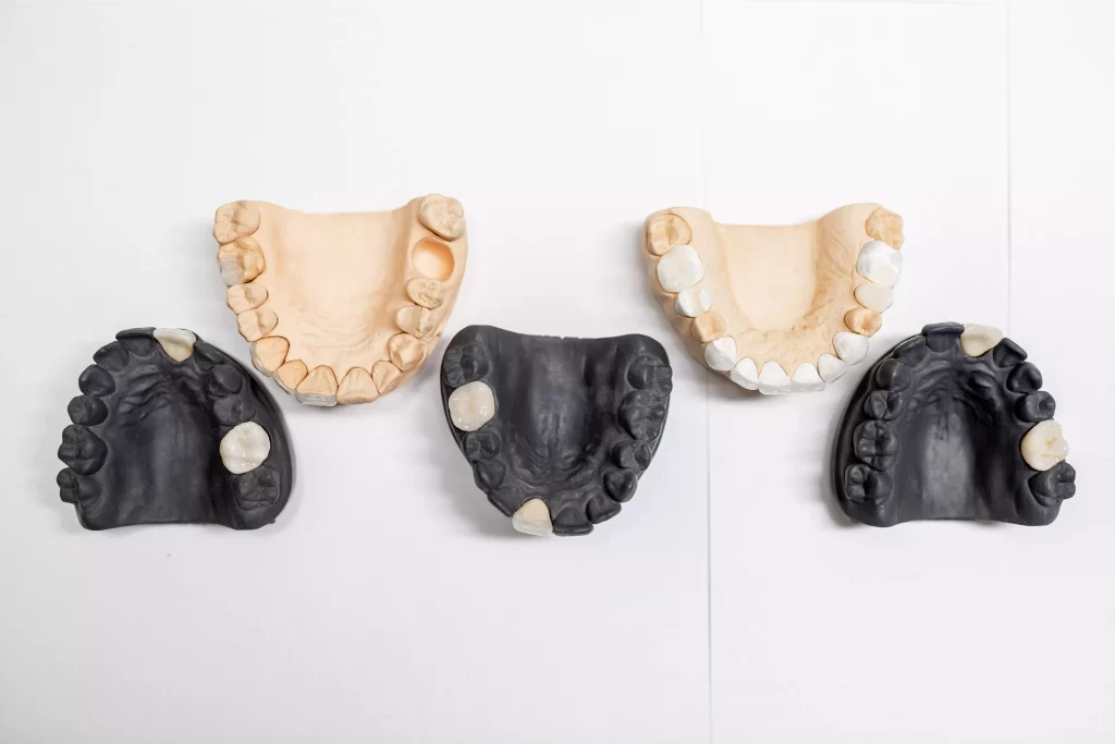 dental-implant-alternatives