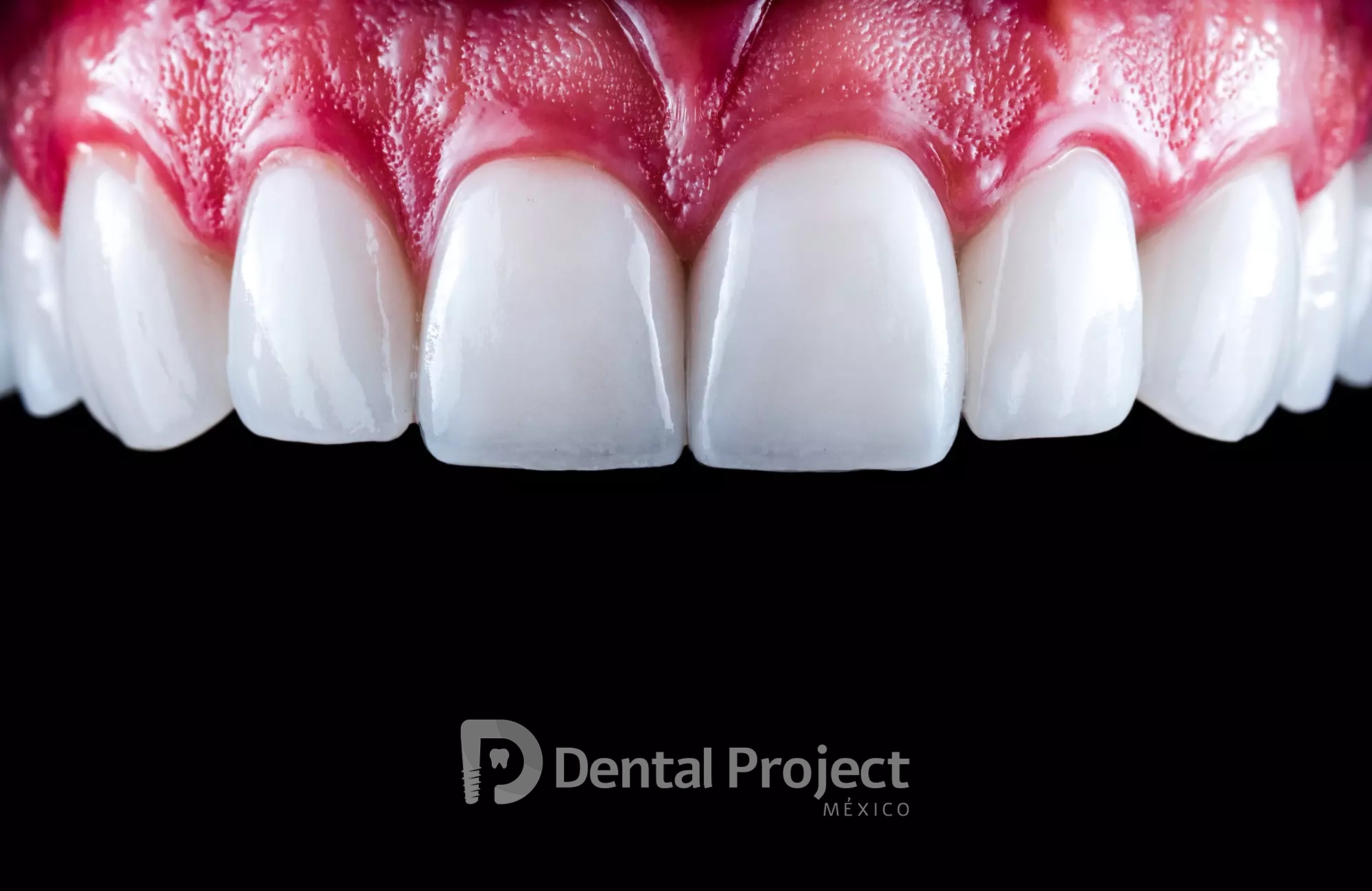 Dental Project Mexico Cosmetic Dentistry.