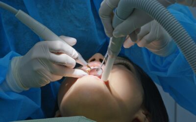 10 Mitos Sobre El Tratamiento de Endodoncia