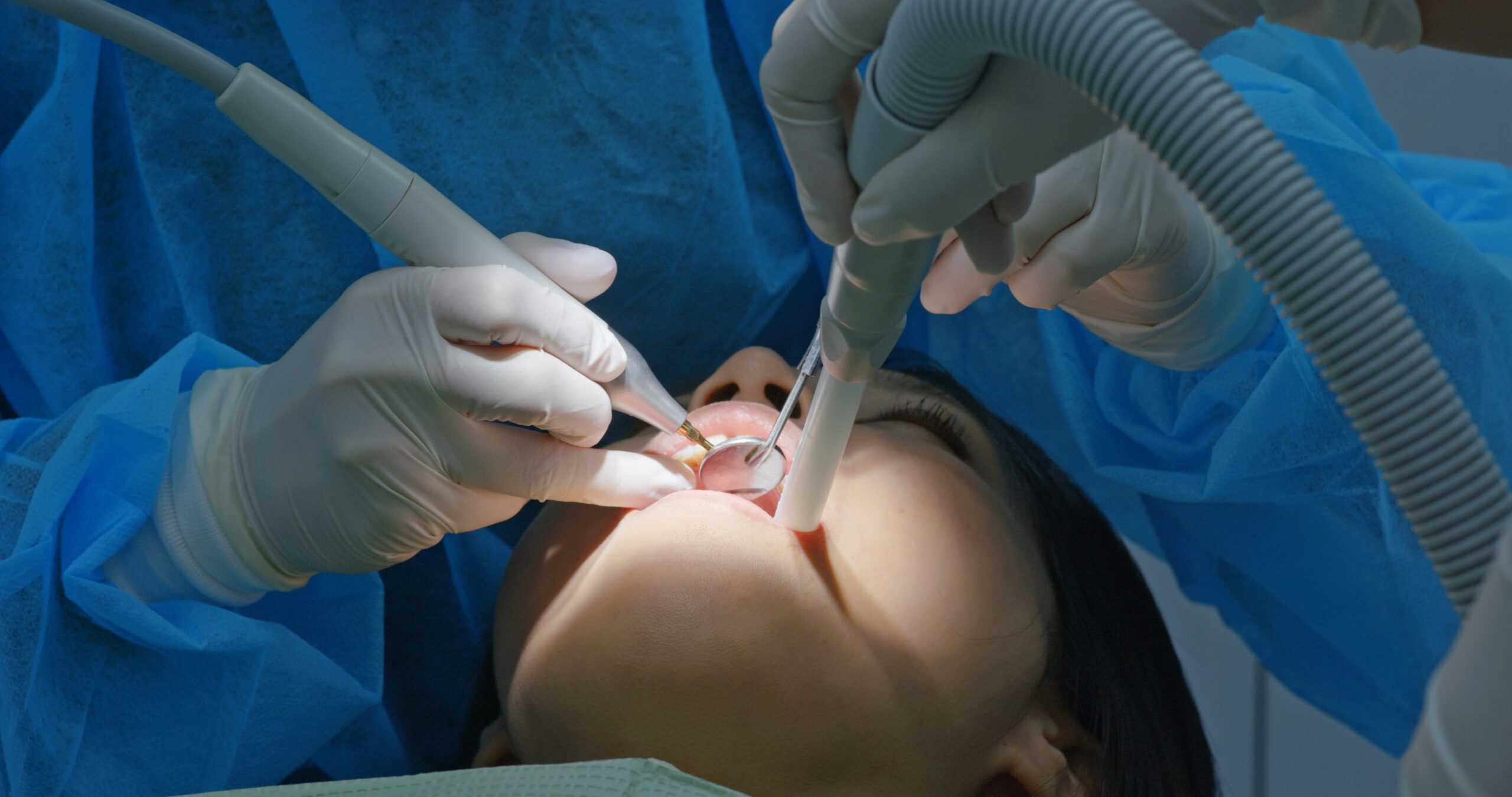 tratamiento-de-endodoncia