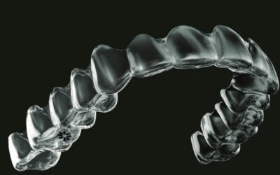 3D Aligners Tijuana: Affordable Smile Makeovers