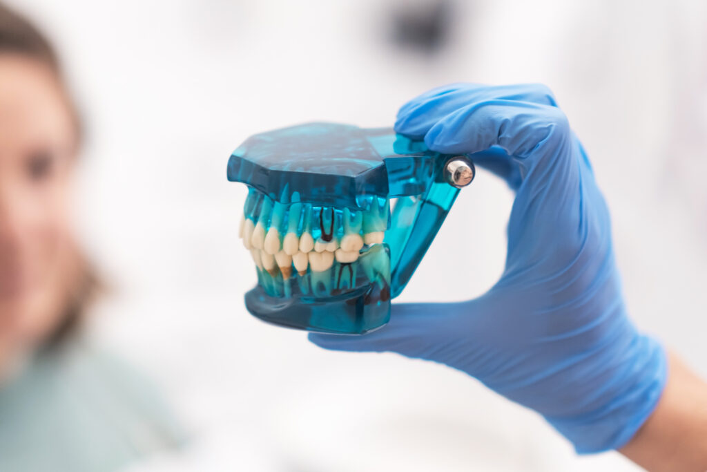 implantes-dentales-planificacion